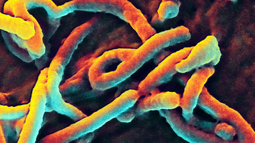ebola-vaccine-on-monky-parsian-australia